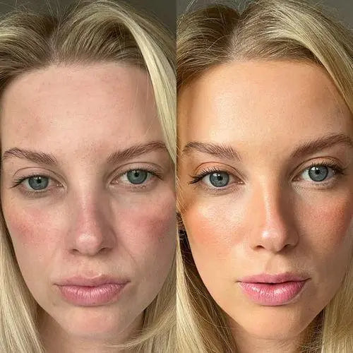 LUXIZ™ - Get a firmer and tighter face naturally Luxiz™️