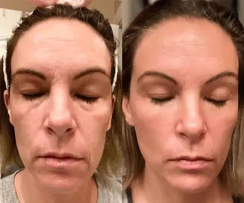 LUXIZ™ - Get a firmer and tighter face naturally Luxiz™️