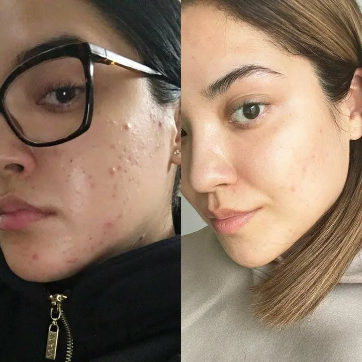 LUXIZ™ - Get a firmer and tighter face naturally Luxiz™️