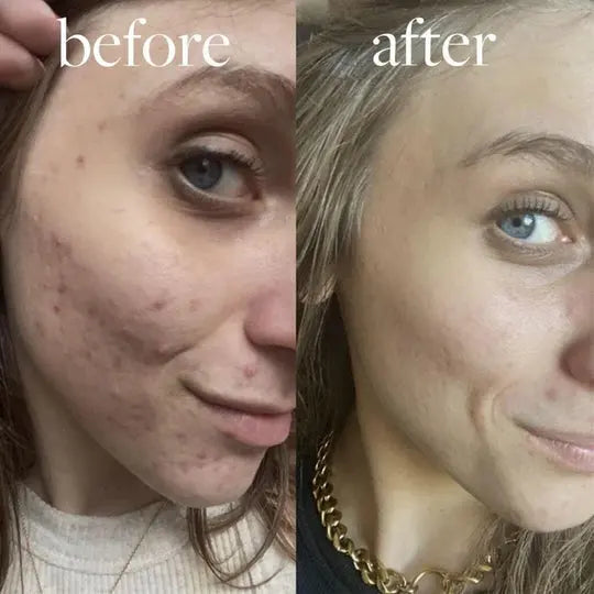 LUXIZ™ - Get a firmer and tighter face naturally Luxiz™️
