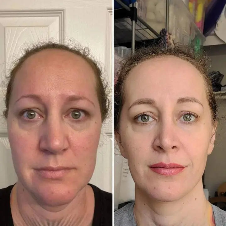 LUXIZ™ - Get a firmer and tighter face naturally Luxiz™️
