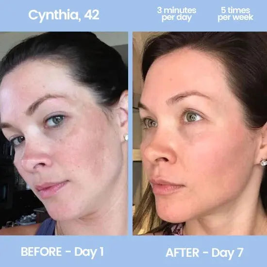 LUXIZ™ - Get a firmer and tighter face naturally Luxiz™️