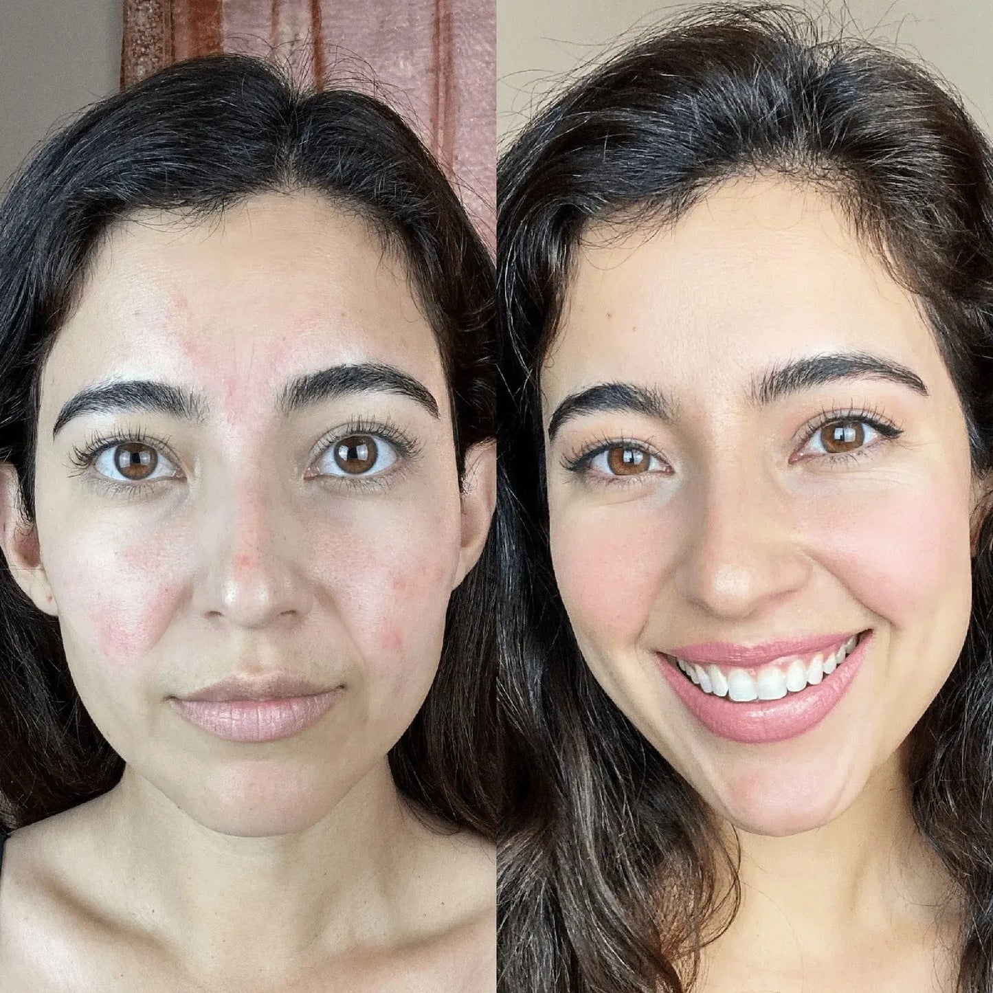 LUXIZ™ - Get a firmer and tighter face naturally Luxiz™️