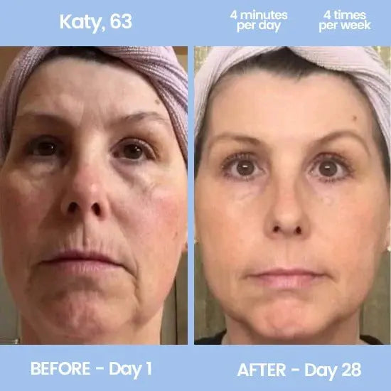 GlowLift Face & Neck Tool