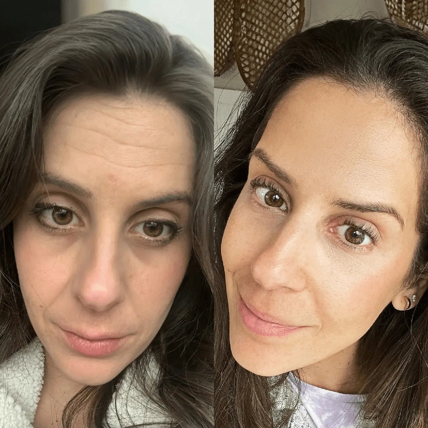 LUXIZ™ - Get a firmer and tighter face naturally Luxiz™️