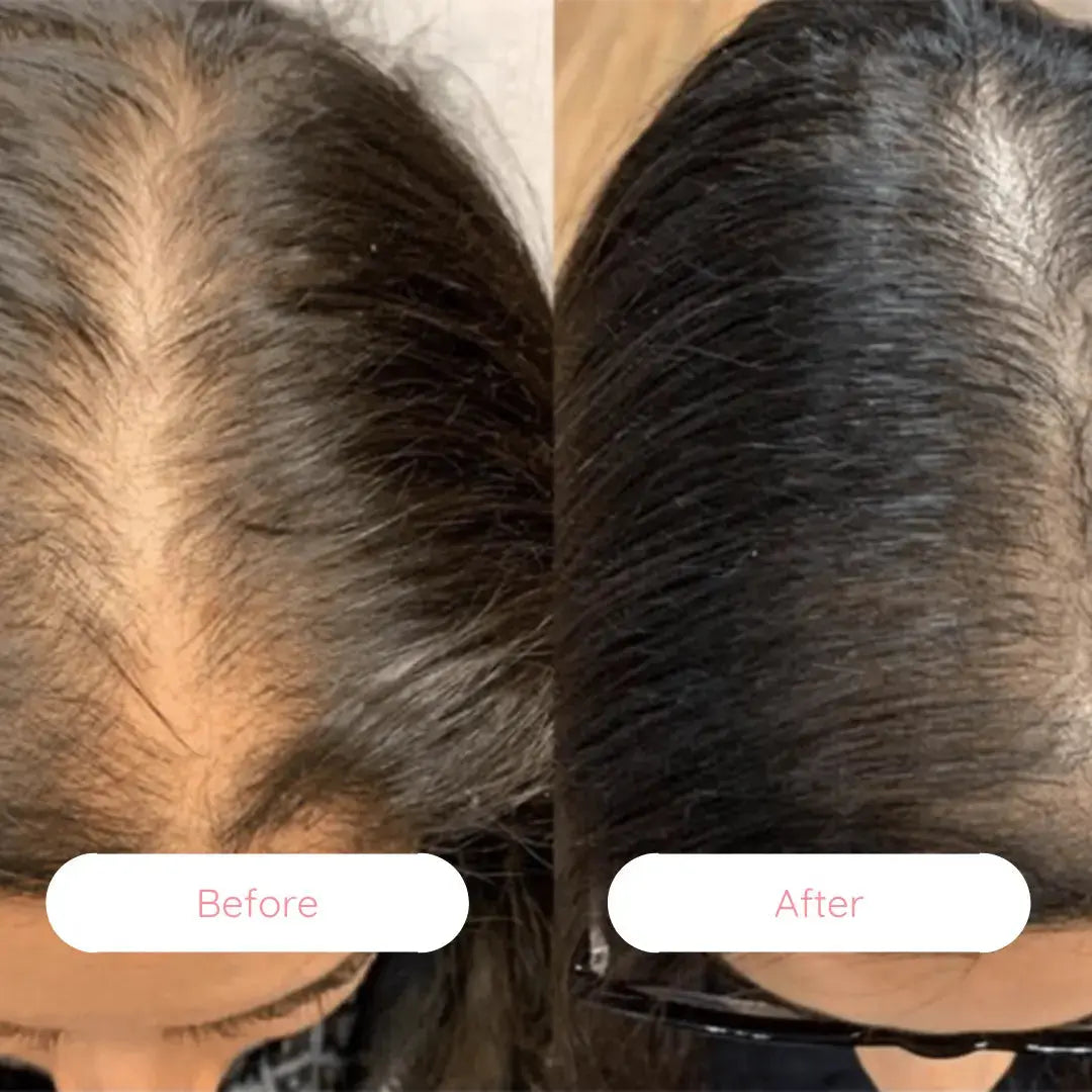 Magic Hair Revive Brush Luxiz™️
