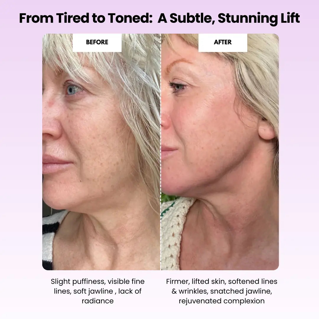 Luxiz™ Glow Sculpt - Beauty Roller Luxiz™️