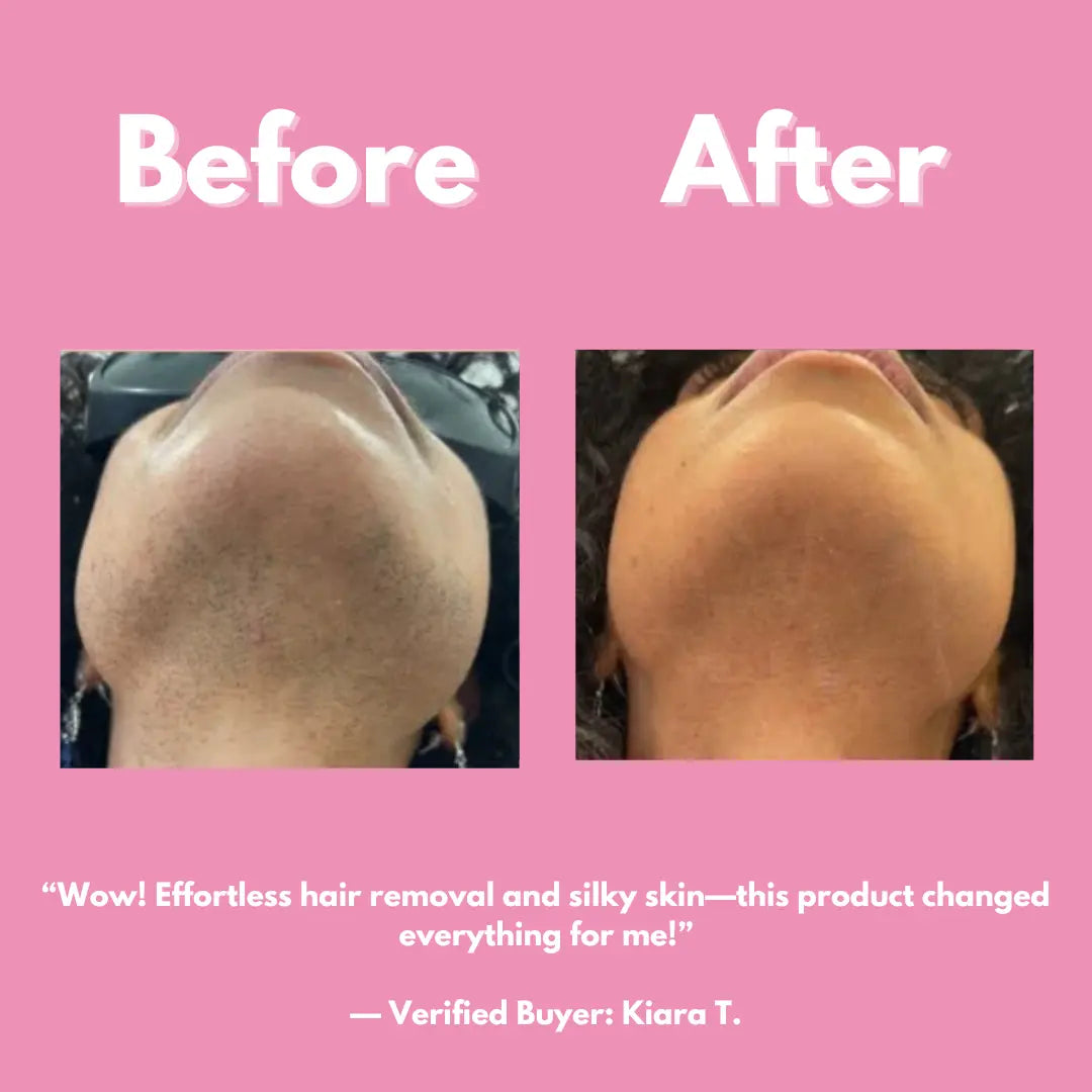 Multi Cosmetics™ Smooth & Shine Hair Removal Kit Luxiz™️