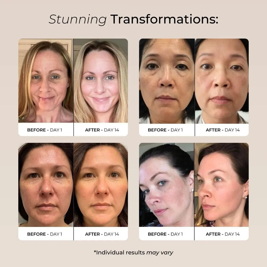 Collagen Skin Balm Luxiz™️