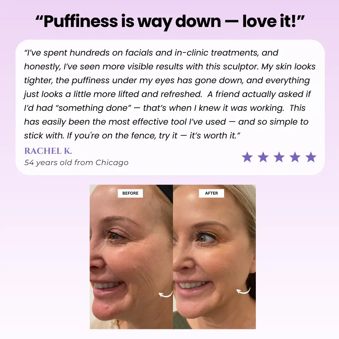 Luxiz™ Glow Sculpt - Beauty Roller Luxiz™️