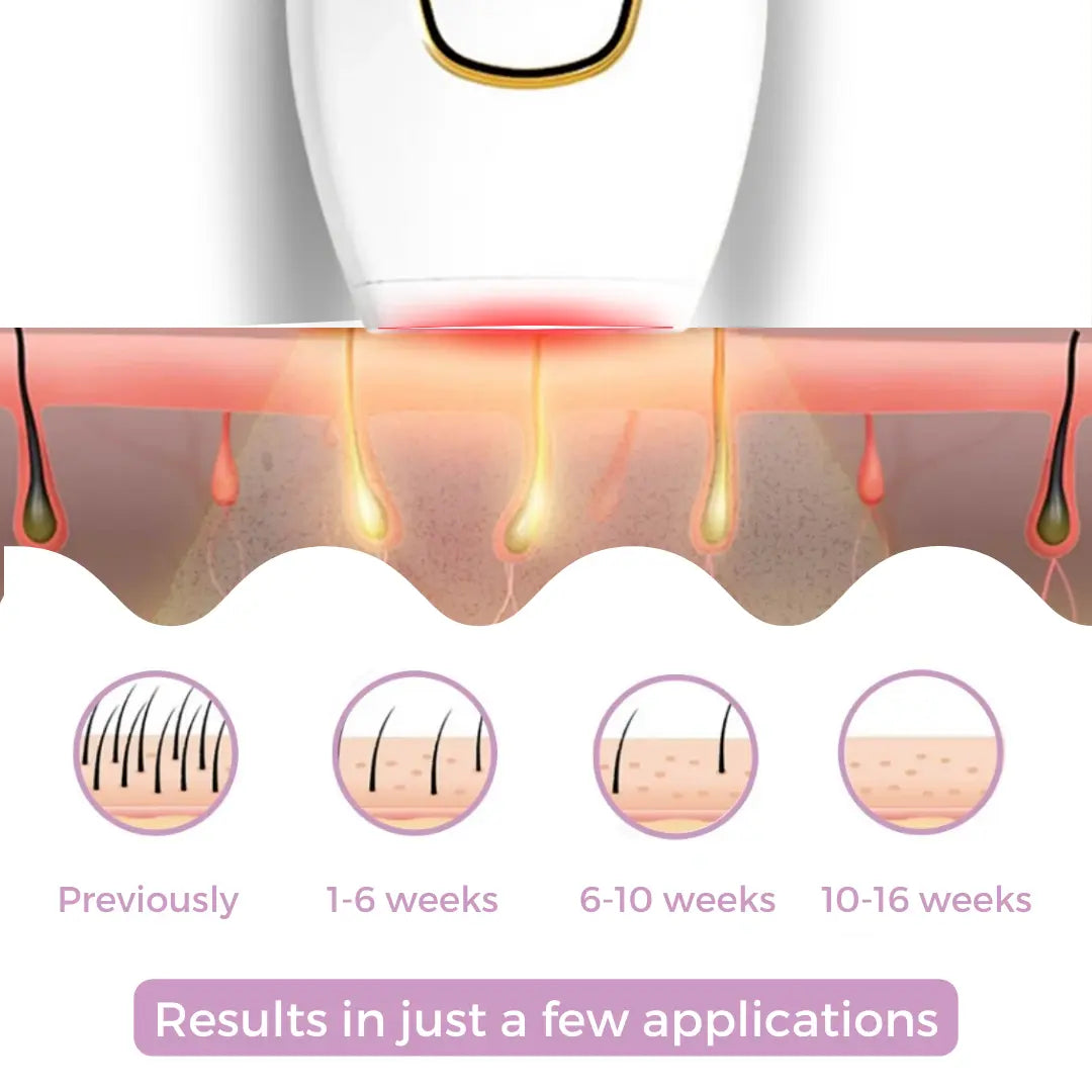Luxiz™ IPL Hair Remover I The leading laser hair removal for your home Phoera™️