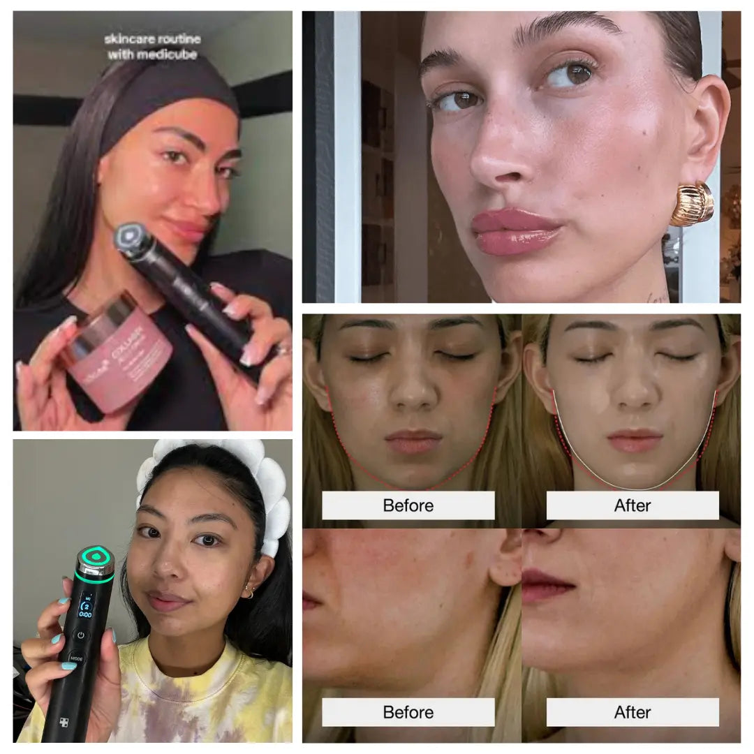 Luxiz™ 6-in-1 Rejuvenation Device Luxiz™️