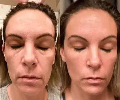LUXIZ™ - Get a firmer and tighter face naturally Luxiz™️