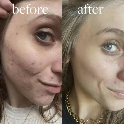 LUXIZ™ - Get a firmer and tighter face naturally Luxiz™️