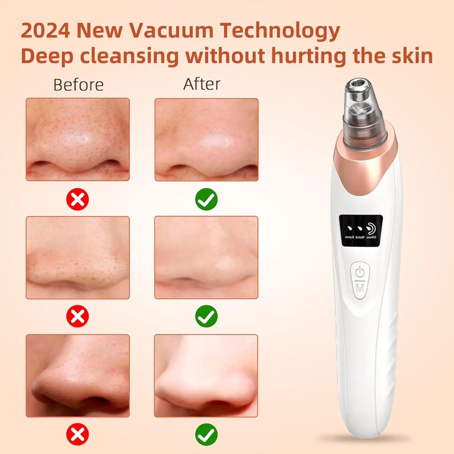 Deep Clean Skin Vacuum