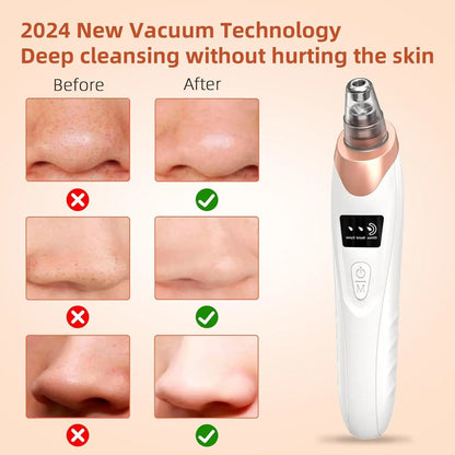 Deep Clean Skin Vacuum