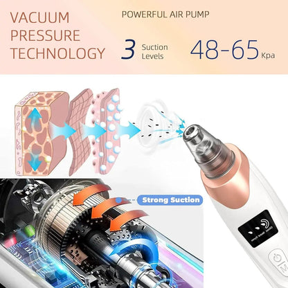 Deep Clean Skin Vacuum