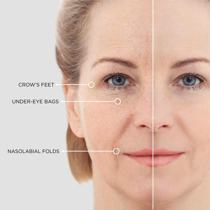 Radiant Eye Magic Patches