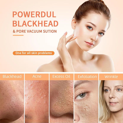 Deep Clean Skin Vacuum