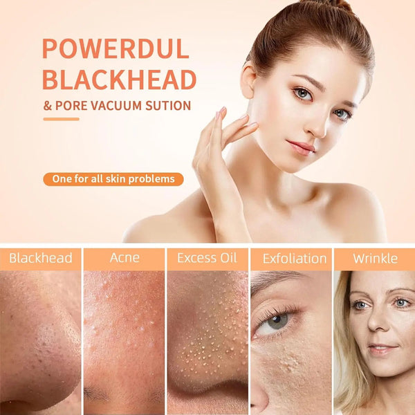 Deep Clean Skin Vacuum