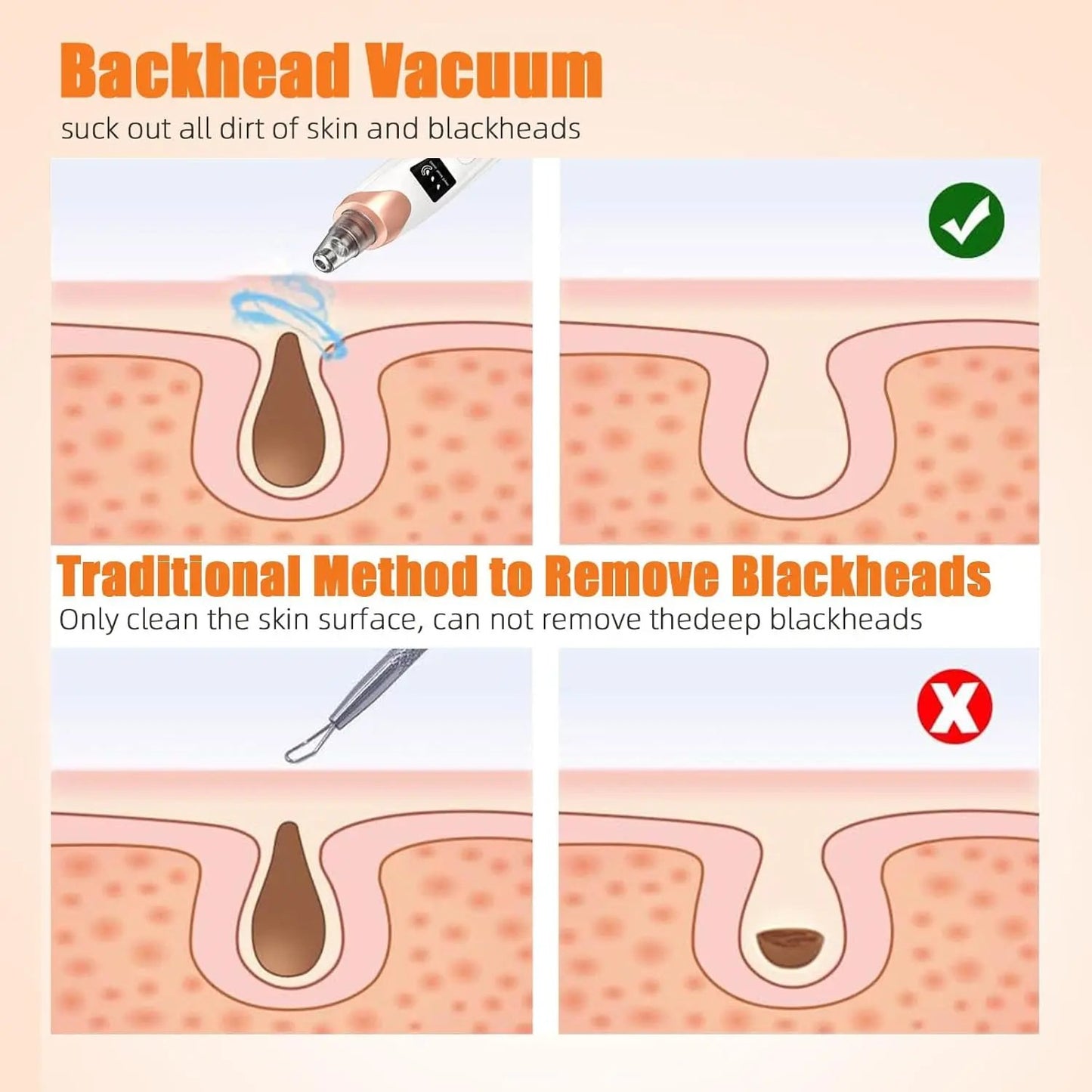 Deep Clean Skin Vacuum